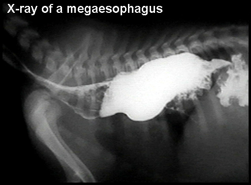 Мегаэзофагус