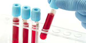 Клинический анализ крови (основные исследования и показатели)